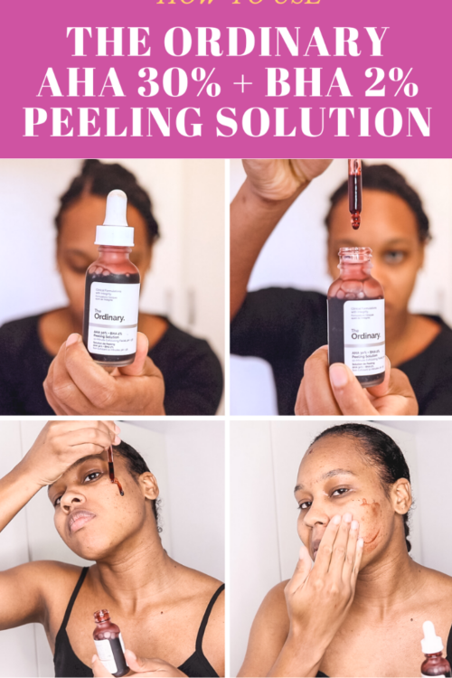 The Ordinary Peeling Solution 2 Weeks Results